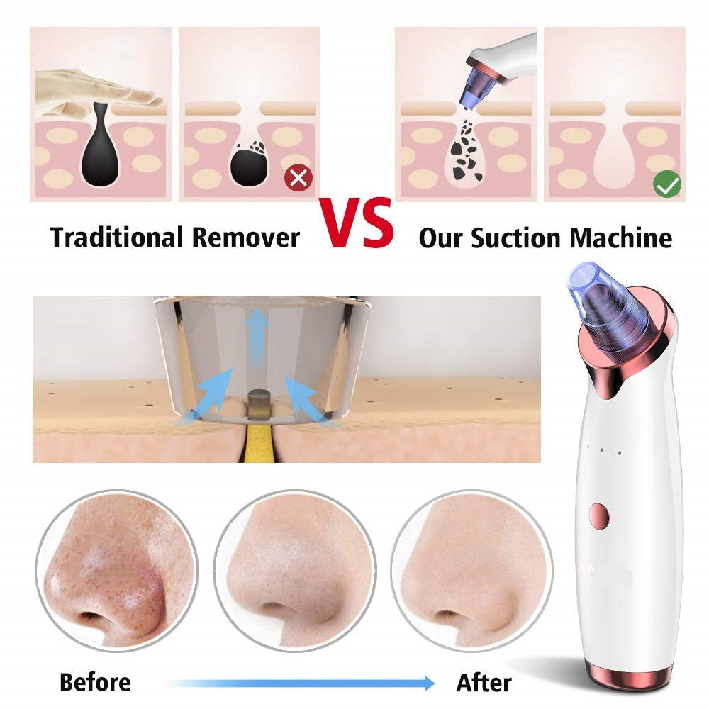 🎉New Year Big Sale 50% Off 🎉Blackhead Cleaner Beauty Instrument